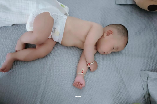 镇江宝宝上火有眼屎